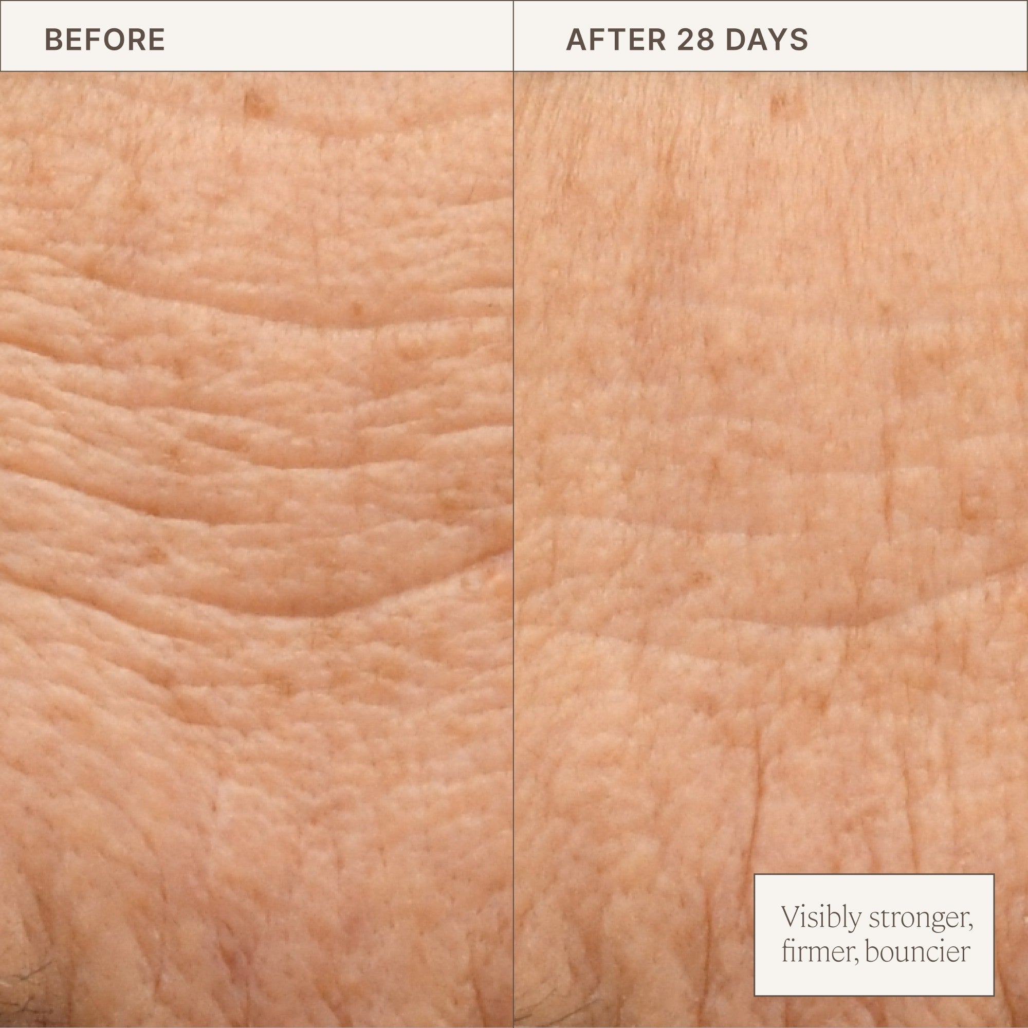 A side by side comparison of skin before applying Barrier Build Cream and after 28 days. The after visibly looks more firm and bouncier.