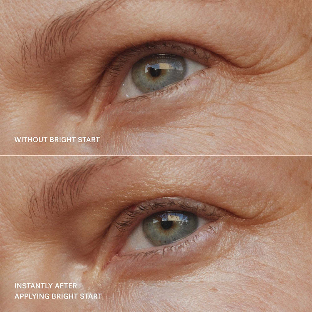 A close up before photo without Bright Start Eye Cream and an instantly after applying Bright Start on a model.